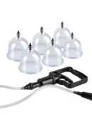 Beginner's 6pc. Cupping Set  Clear/ Black – Bild 4
