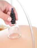 Beginner's 6pc. Cupping Set  Clear/ Black – Bild 5